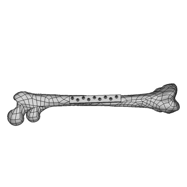 Femur Bone With Zk60 Plate - Standard Mechanical Component