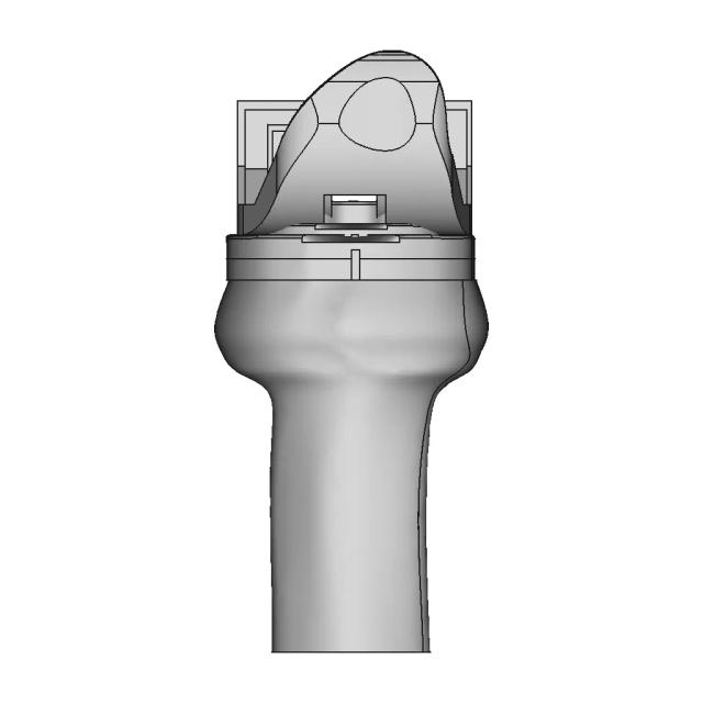 Knee Replacement | High-Quality CAD Model