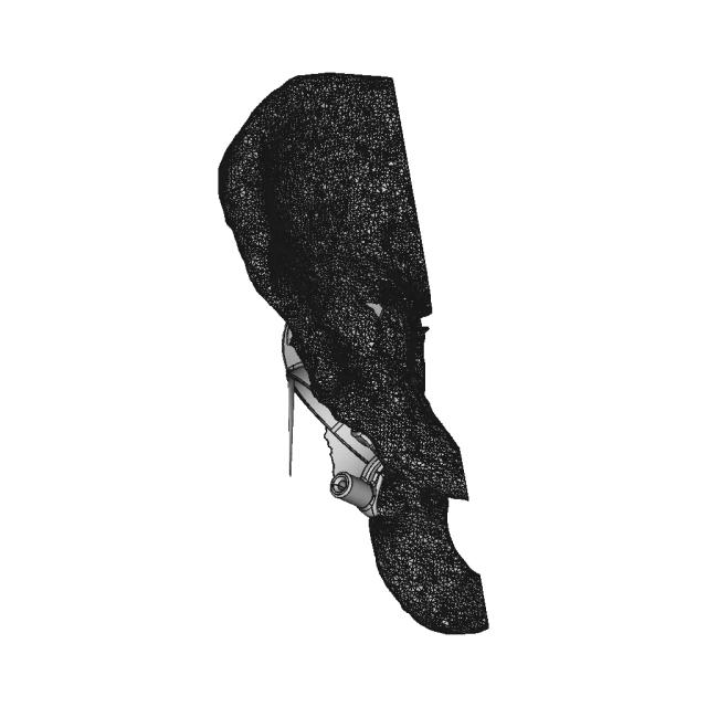 Hip Cavity Implant | 3D Engineering Design File