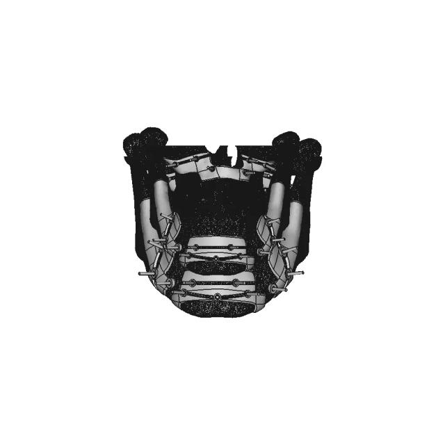 Guiders For Jaws Osteotomy - Downloadable CAD Representation