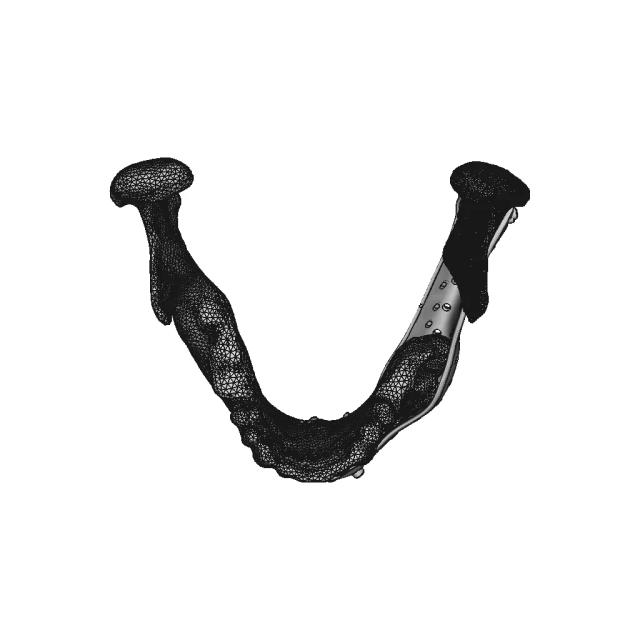 Lower Jaw Prosthesis - Downloadable CAD Representation