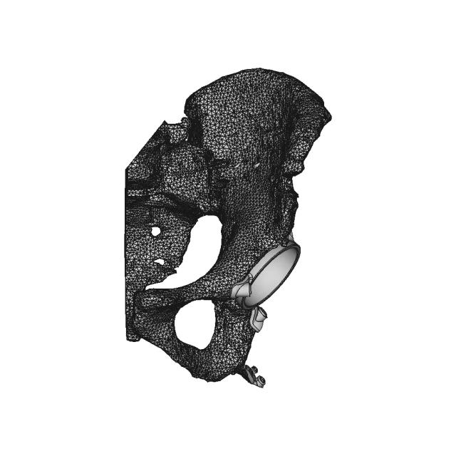 Hip Cavity Implant | 3D Engineering Design File